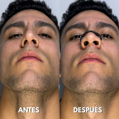 Tiras Nasales Magneticas